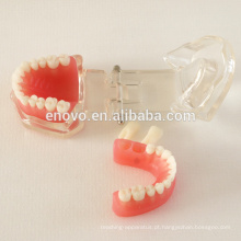 China Modelo dental padrão anatômico médico 13017 da mandíbula da gengiva macia removível modelo anatômica